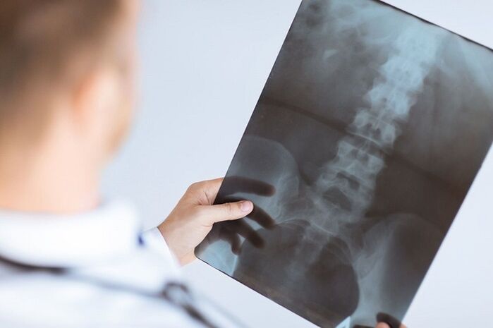 Az ágyéki osteochondrosis diagnosztikai lehetőségei