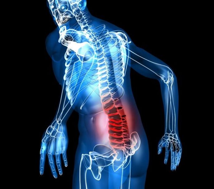 az ágyéki osteochondrosis fokozat és fejlődési szakaszai