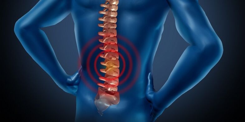 Az ágyéki régió osteochondrosis