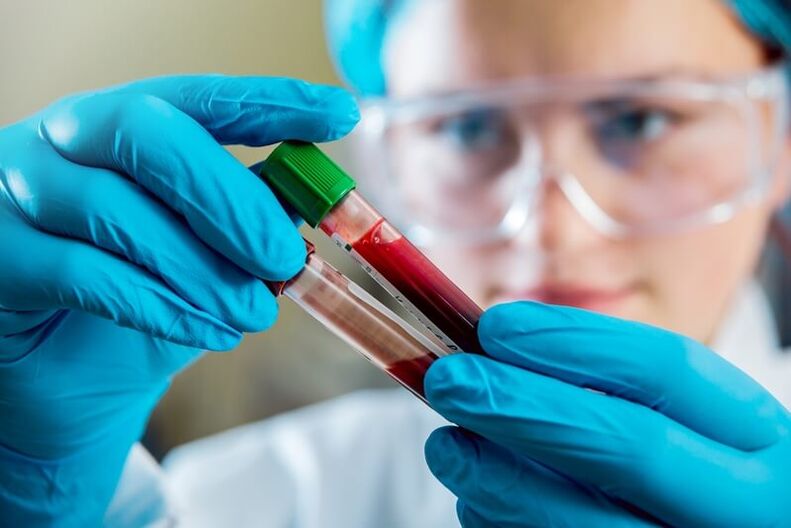 Teljes vérvizsgálat a derékfájás diagnosztizálására